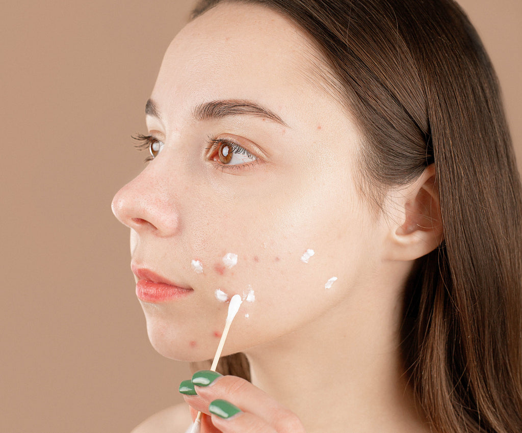 Top 5 Best Hormonal Acne Cleansers