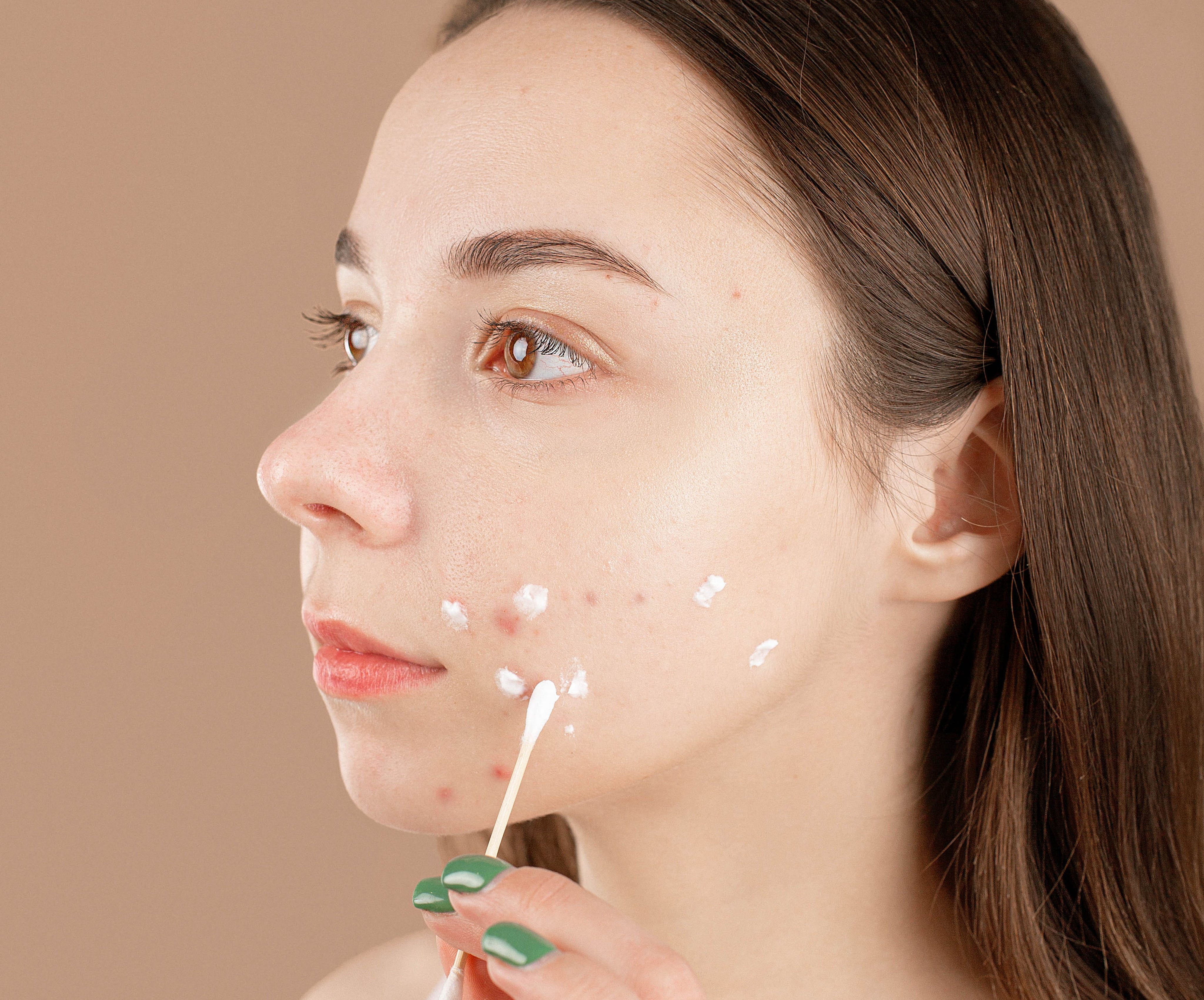 Top 5 Best Hormonal Acne Cleansers Girlboss
