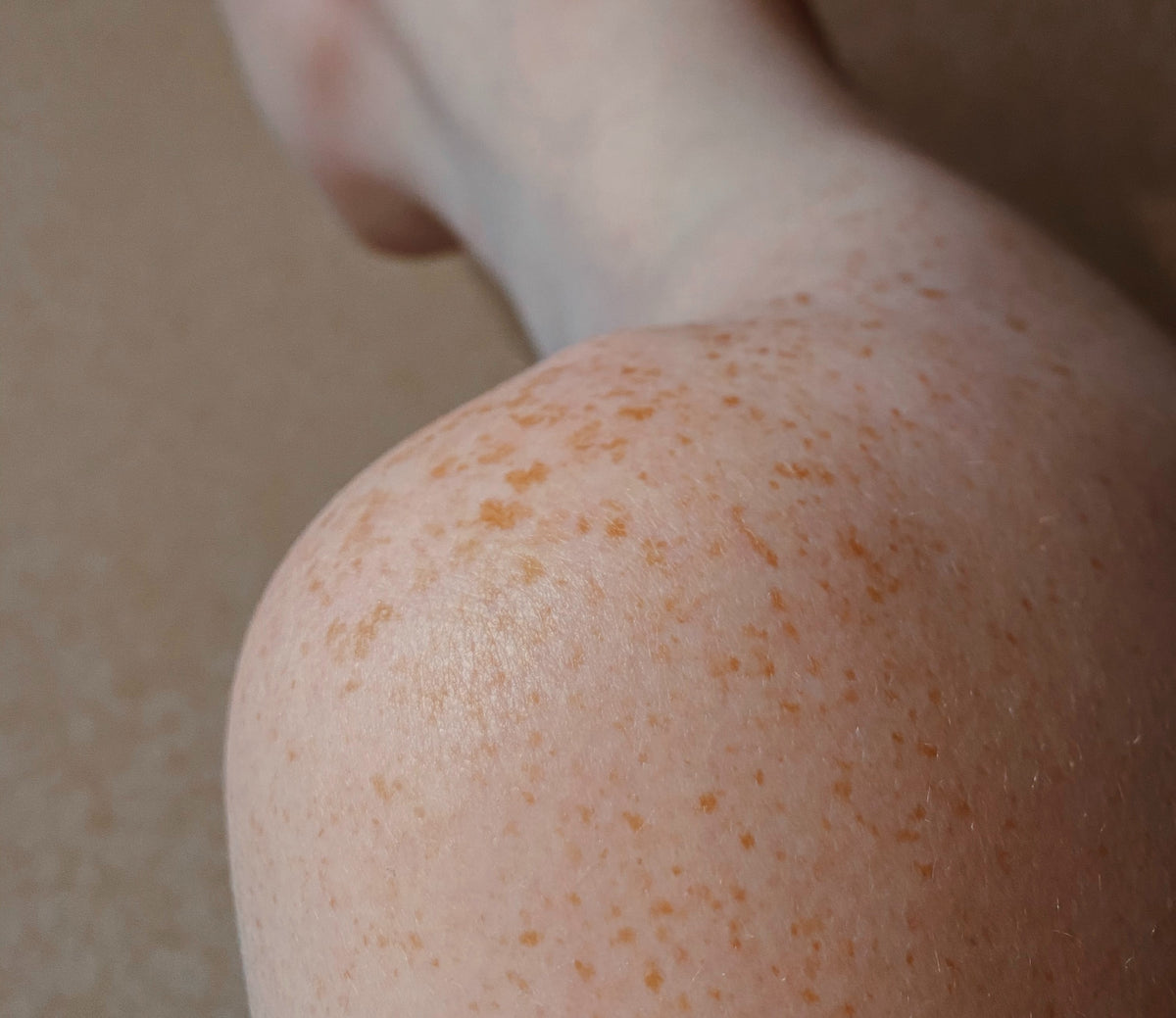 Best Aloe for Sunburn Top 5 Effective Options Girlboss